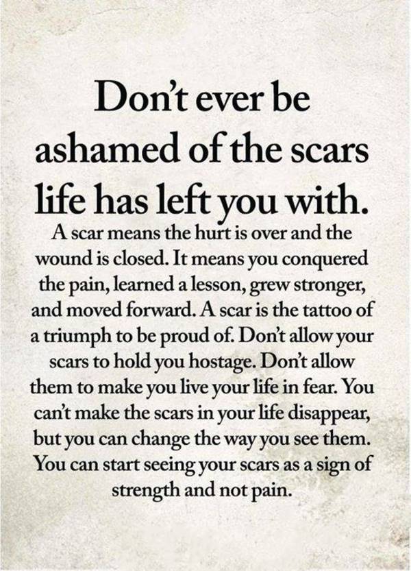 Perseverance quote on life. Do not ever be ashamed of the scars for which life has left you. 